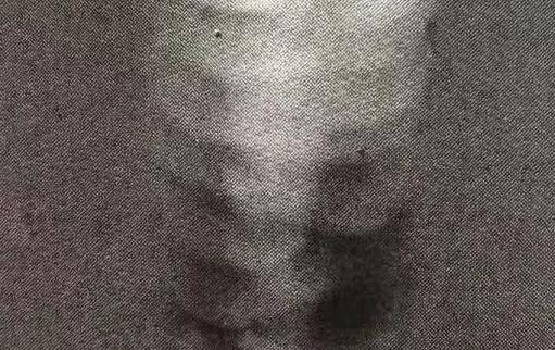 Comparison Atlas of Welding Defects and Non-Destructive Testing Images 41 增不足