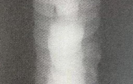 Comparison Atlas of Welding Defects and Non-Destructive Testing Images 42 根部焊瘤