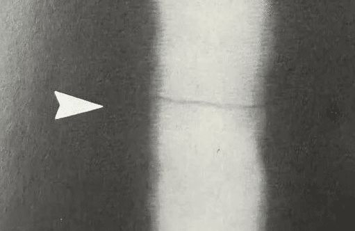 Comparison Atlas of Welding Defects and Non-Destructive Testing Images 28 横向裂纹